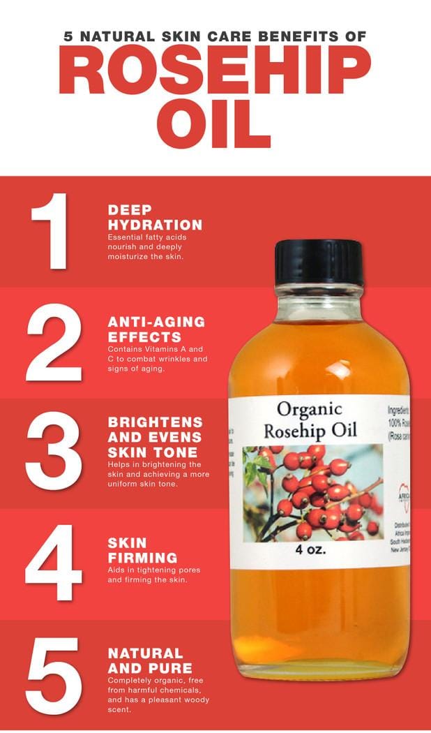 🌹 Organic Rosehip Oil – 4 oz